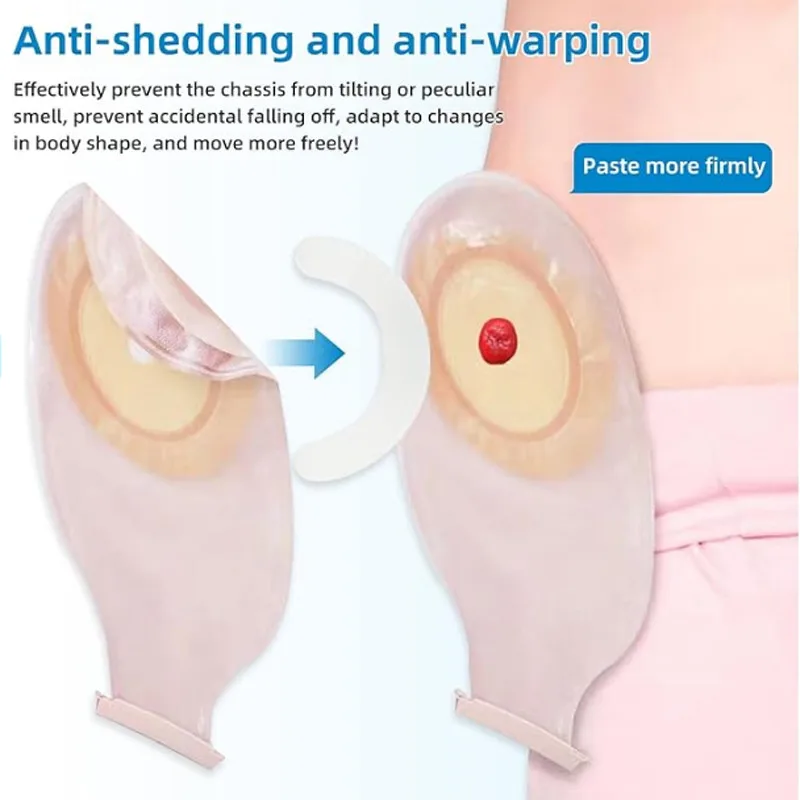 Medical Tape - Bande de renforcement pour poche stomatique